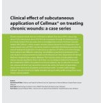 WAS_2022_5_3_Cellmax print Clinical effect of subcutaneous application of Cellmax® on treating chronic wounds: a case series