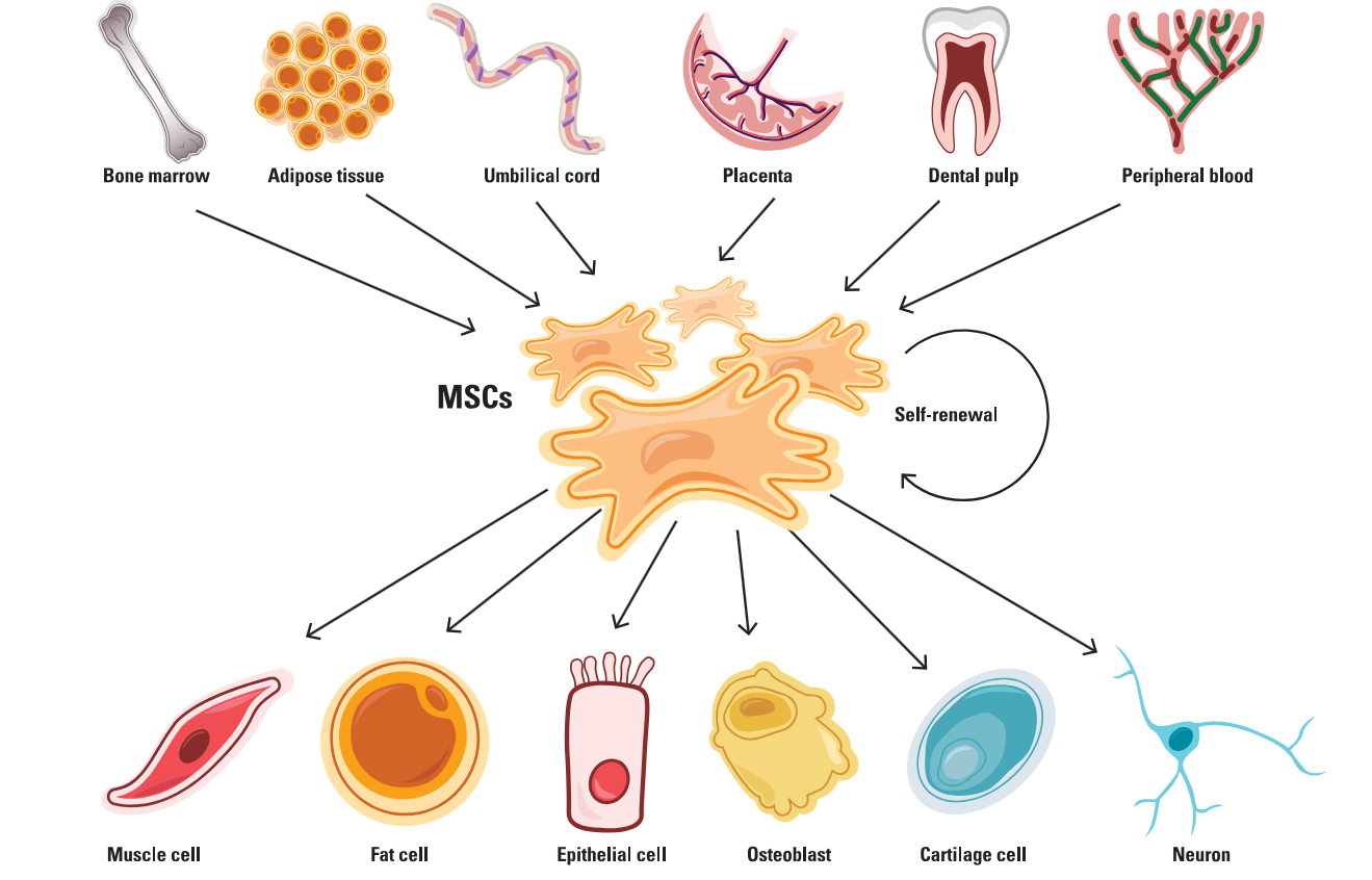Mesenchymal Stem Cells (MSCs) Therapy In Malaysia